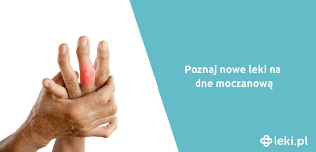 Jakie leki na kwas moczowy mogą naprawdę przynieść ulgę? Jakie leki na kwas moczowy mogą naprawdę przynieść ulgę?